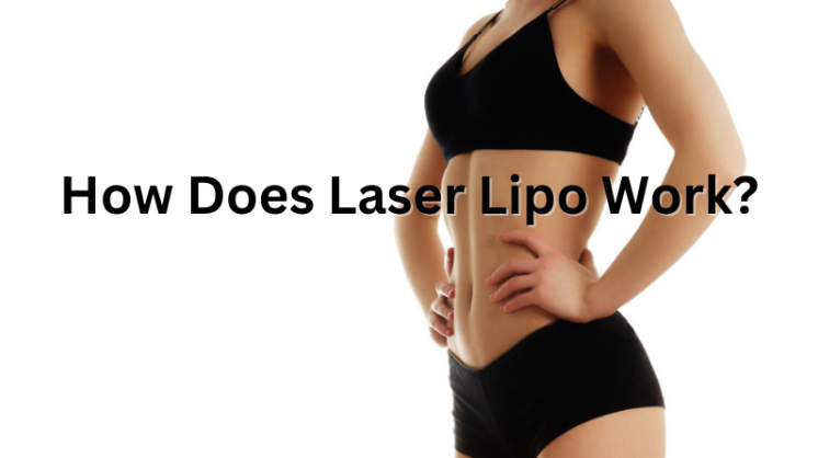 Máy lipolysis laser hoạt động như thế nào?