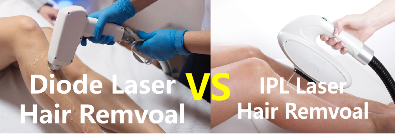 TRỤC TÓC IPL VS DIODE LASER