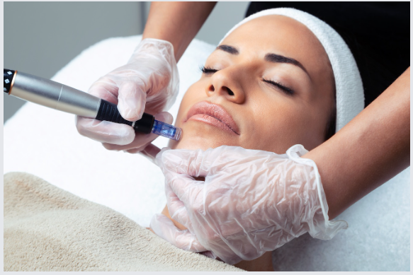 Sự khác biệt giữa microneedling và mesotherapy là gì?