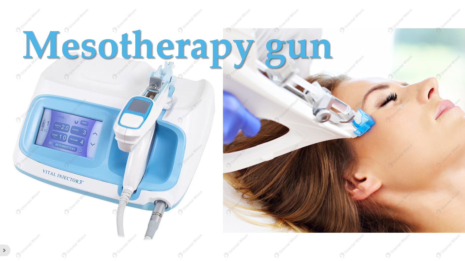 “Tiêm Mesotherapy” thú vị và đáng sợ là gì?