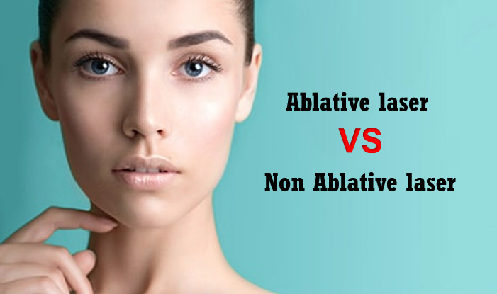 Sự khác biệt trên laser ablative và không Ablative là gì?