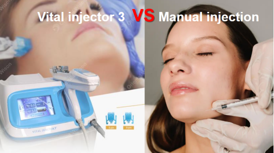 Những lợi thế của kim phun quan trọng so với tiêm thủ công