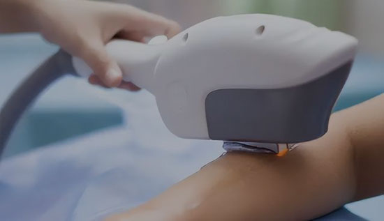 Máy Laser IPL