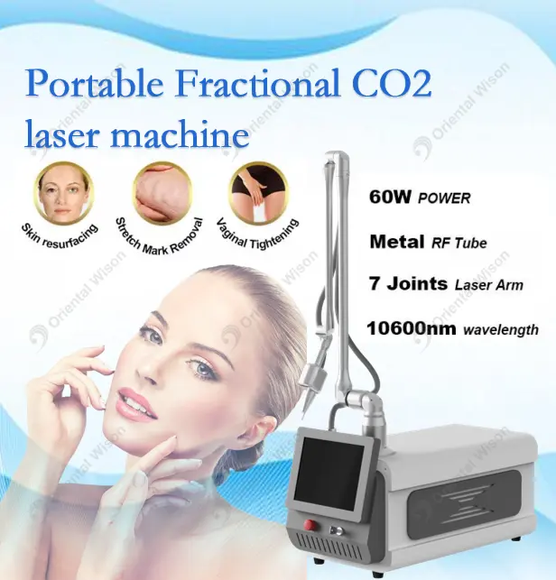 Máy laser CO2 phân đoạn di động