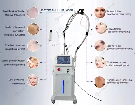 Phân số dọc 1927nm Thulium laser da chống lão hóa da
